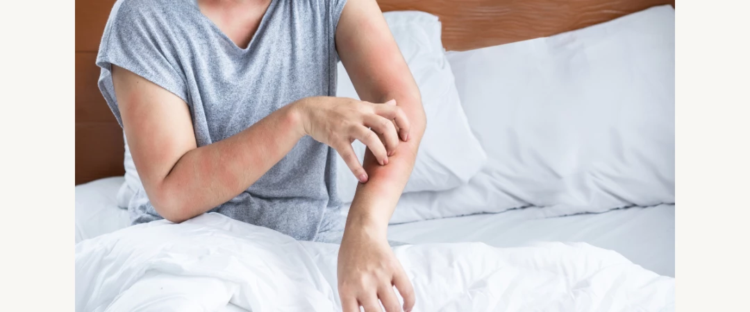 #méthode anti punaise de lit #désinfection naturelle punaise de lit #désinfecteur de punaise de lit #désinfection anti punaise Aix Les Bains